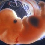 Human Embryos