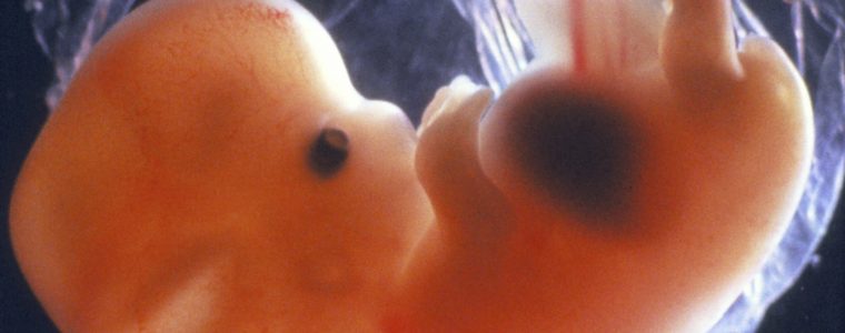 Human Embryos Have Gills: A Myth?