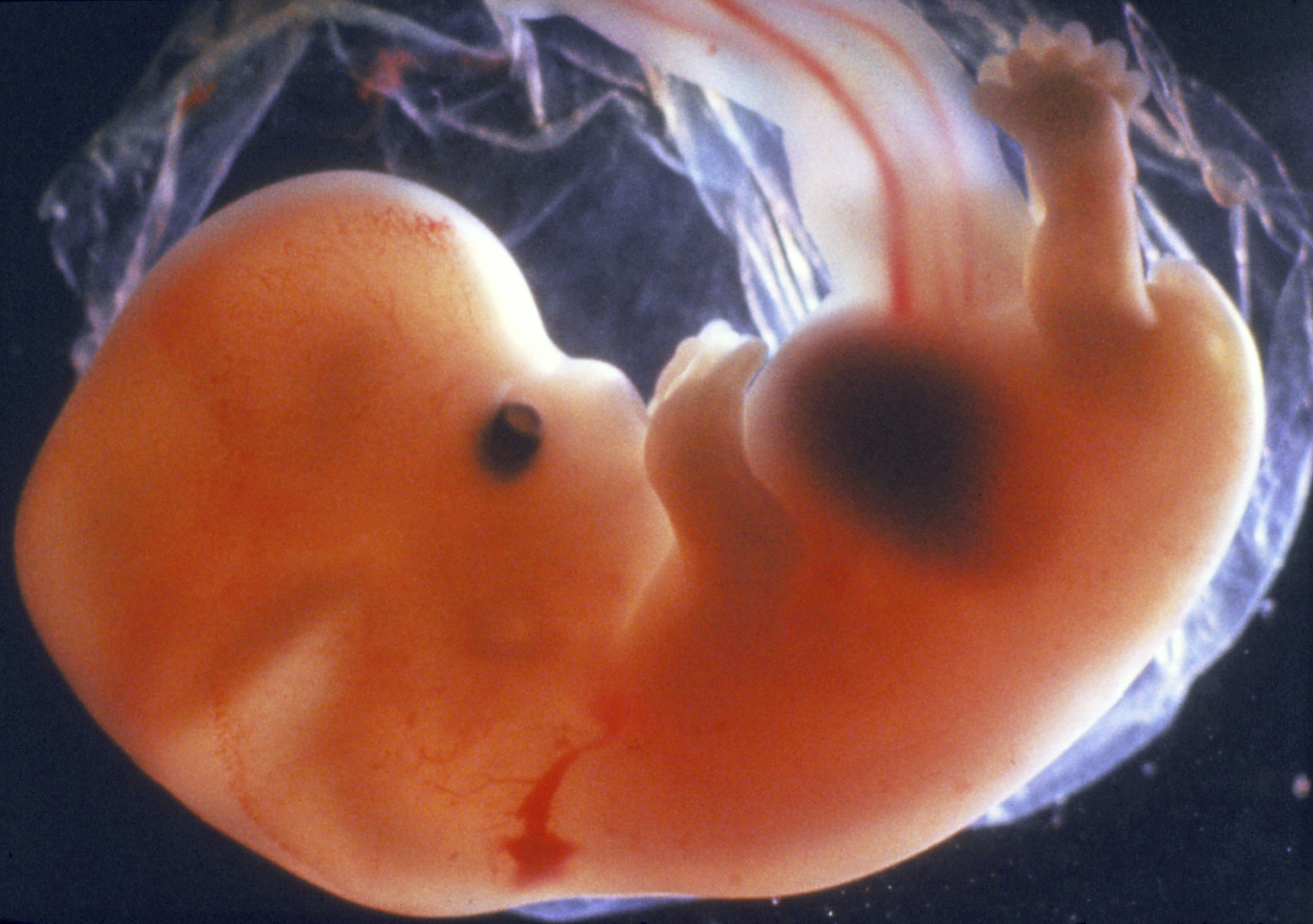 Human-Embryos-Have-Gills-A-Myth.jpg